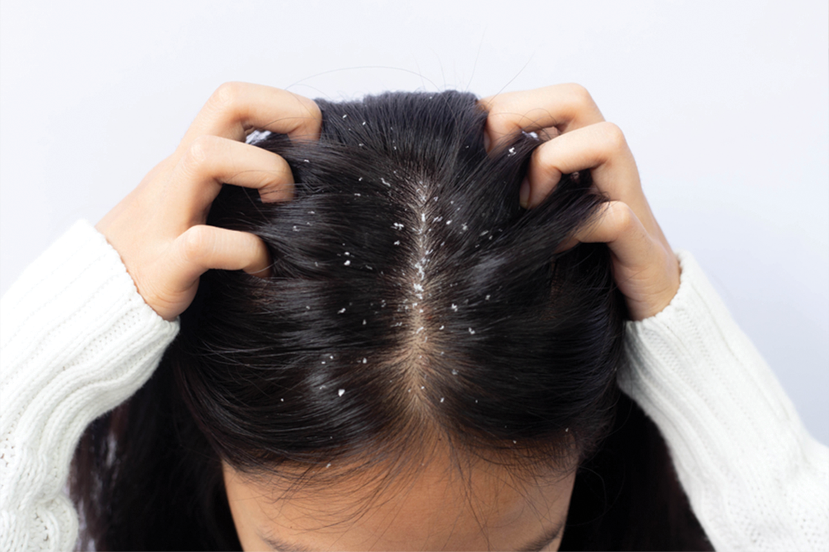 Mjällbehandling & Scalp Care